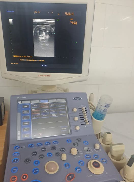LỒNG RUỘT Ở TRẺ EM