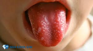 HỎI BỆNH THÀNH HỎI CÁC MÓN ĂN